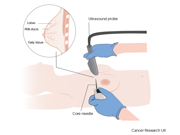 NOSTRA Trial Diagram