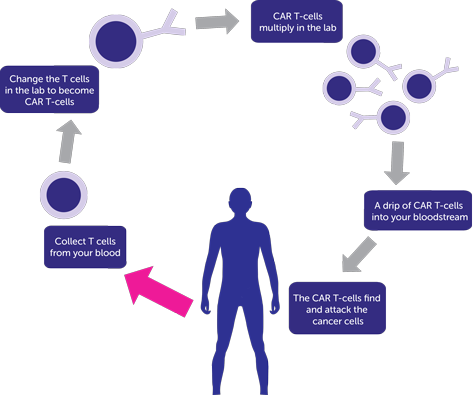 ALEXANDER trial diagram car t-cell therapy 