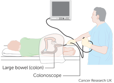 CT-Scan Diagram- 15470