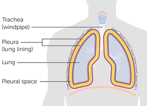 INFINITE Trial Diagram