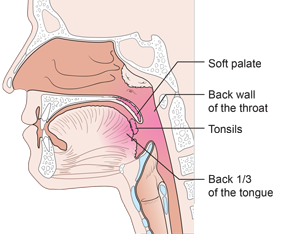 De-ESCALaTE HPV Trial Diagram 