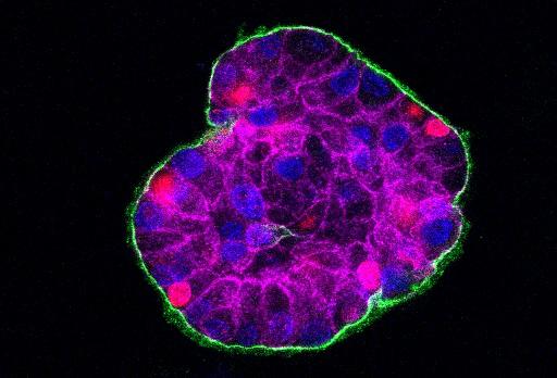 breast precancer cell colony in 3D (credit Dr Gilmore and Simon Saadati, University of Manchester)