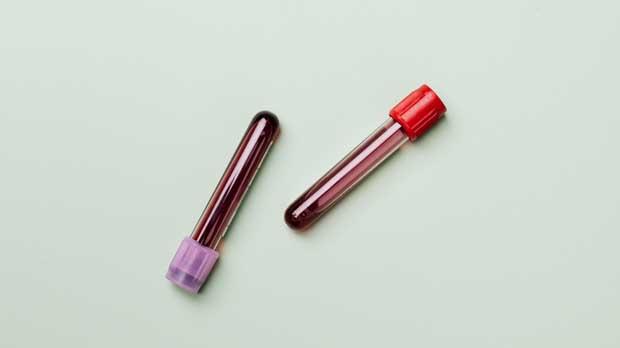 Blood test samples