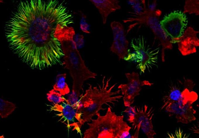 Dendritic cells Dendritic cells