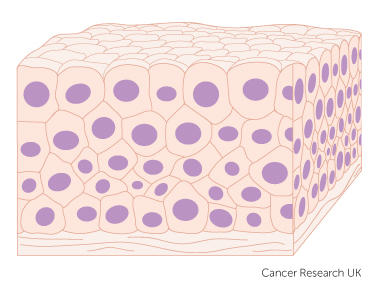 transitional cells