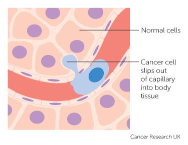 how cancer cells get into the bloodstream