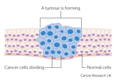 Image: Cancer Research UK