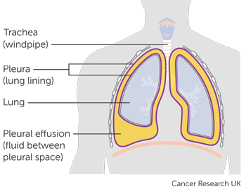 Diagram for TIME1