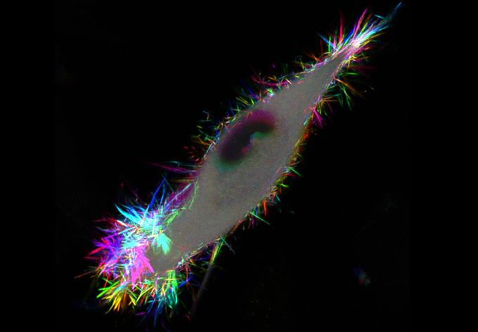 Fascin Firework Fascin Firework, pancreatic cancer cell. Image credit: Dr Nikki Paul, CRUK Beatson Institute
