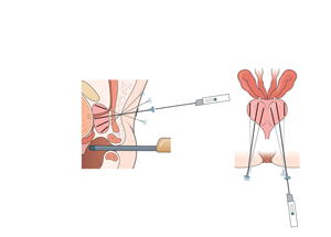 CamPROBE Trial Diagram