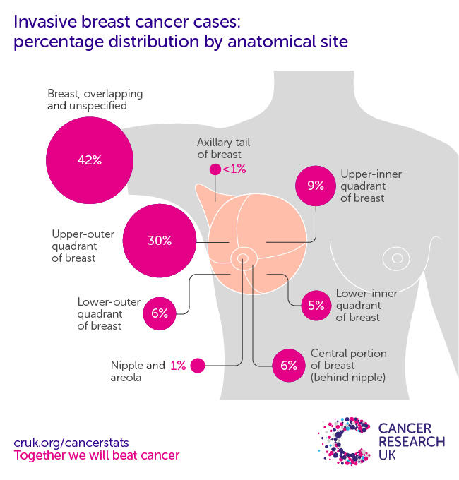 Infographic showing the most common specific location for invasive breast cancers in the UK is the upper-outer quadrant of the breast (2016-2018).