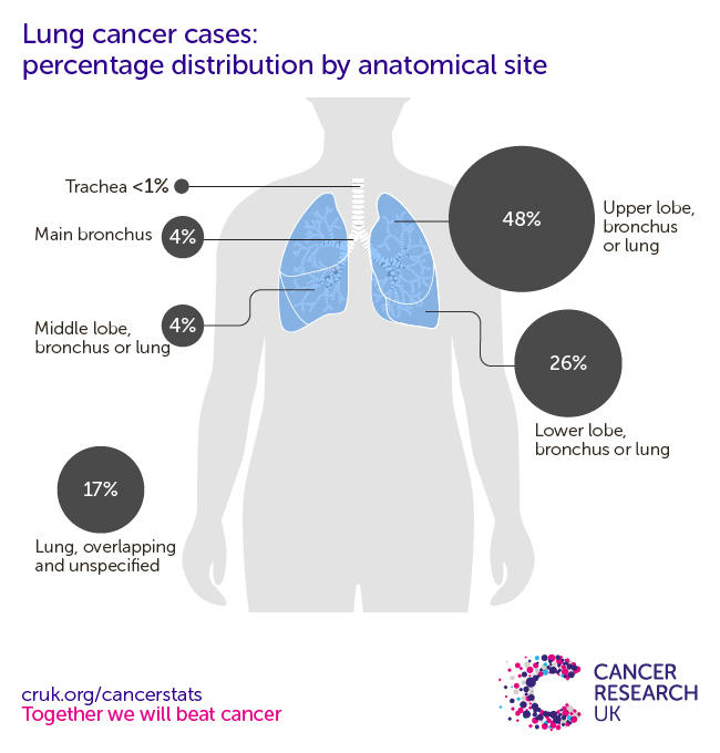 Average Age Of Lung Cancer In Smokers