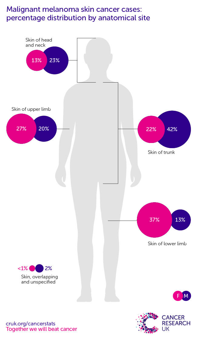 Melanoma skin cancer incidence statistics Cancer Research UK
