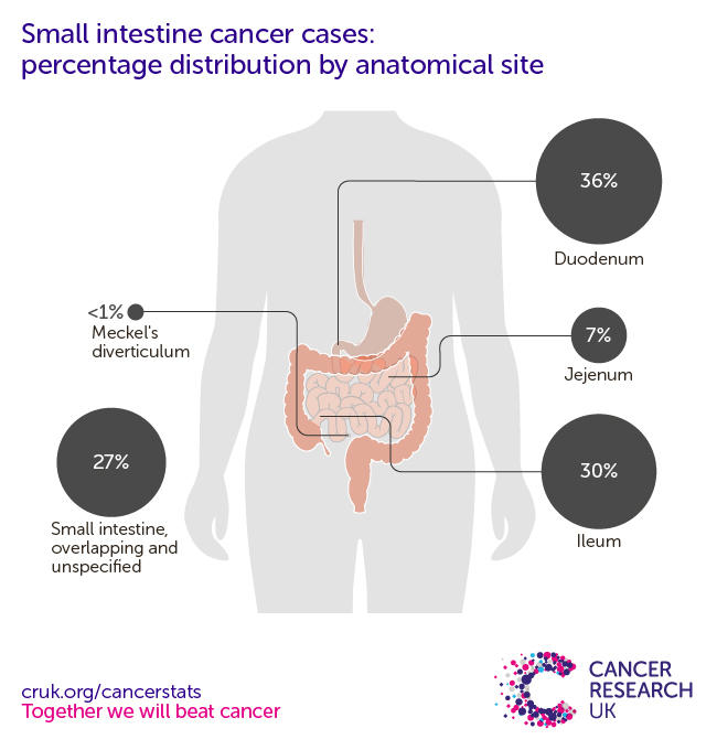 Small intestine cancer incidence statistics | Cancer Research UK