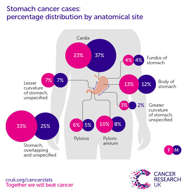 Stomach cancer incidence statistics Cancer Research UK