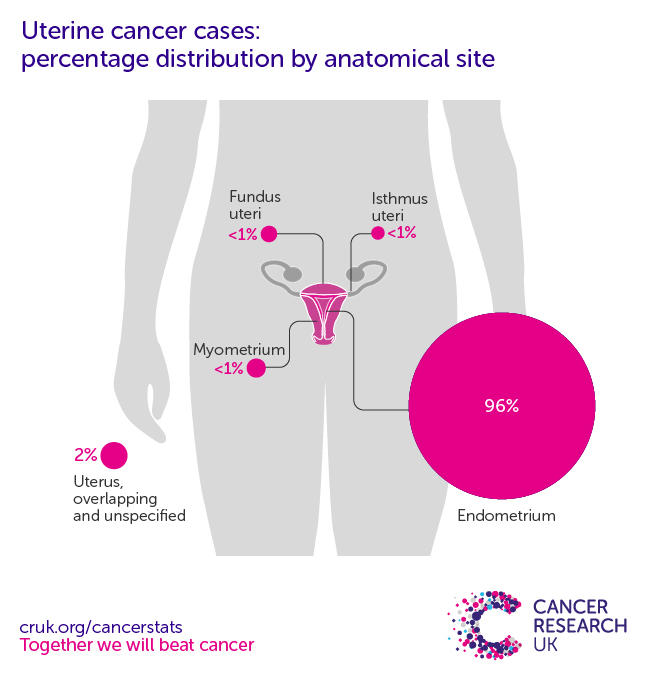 Infographic to show the most common specific location for uterine cancers in the UK in the endometrium