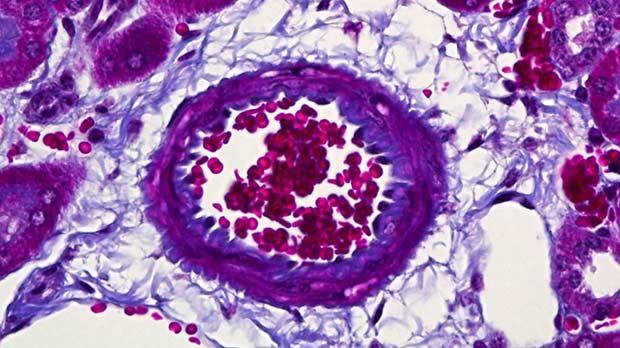 Slide showing a kidney blood vessel.