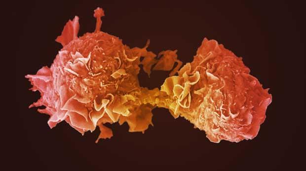 Lung cancer cell Lung cancer cell