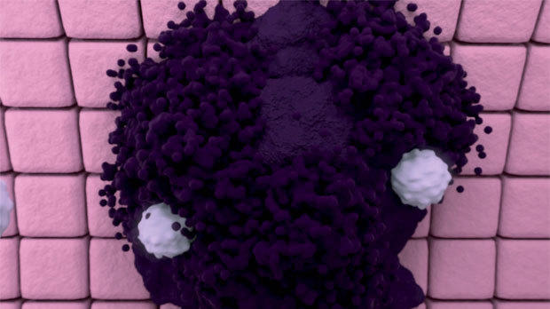 An illustration of T cells (white) attacking a tumour (purple) An illustration of T cells (white) attacking a tumour (purple)