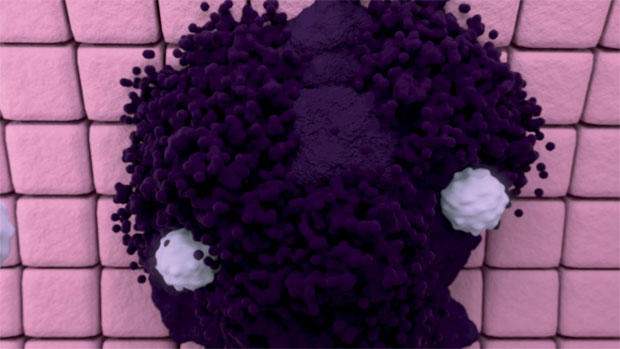 Graphic of T-cells attacking a cancer cell Graphic of immune cells attacking a cancer cell