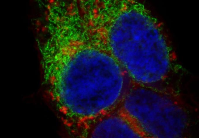 cancer cells