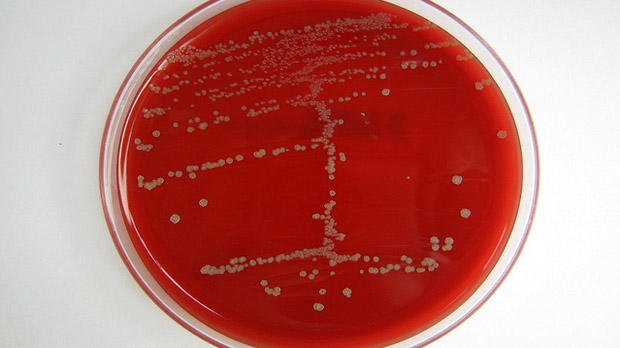 Fusobacterium nucleatum Fusobacterium nucleatum