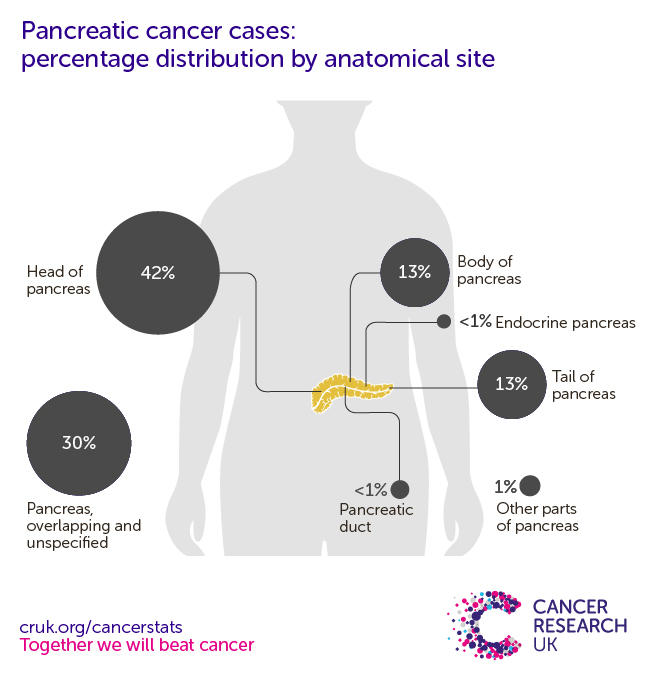 Average Age For Pancreatic Cancer
