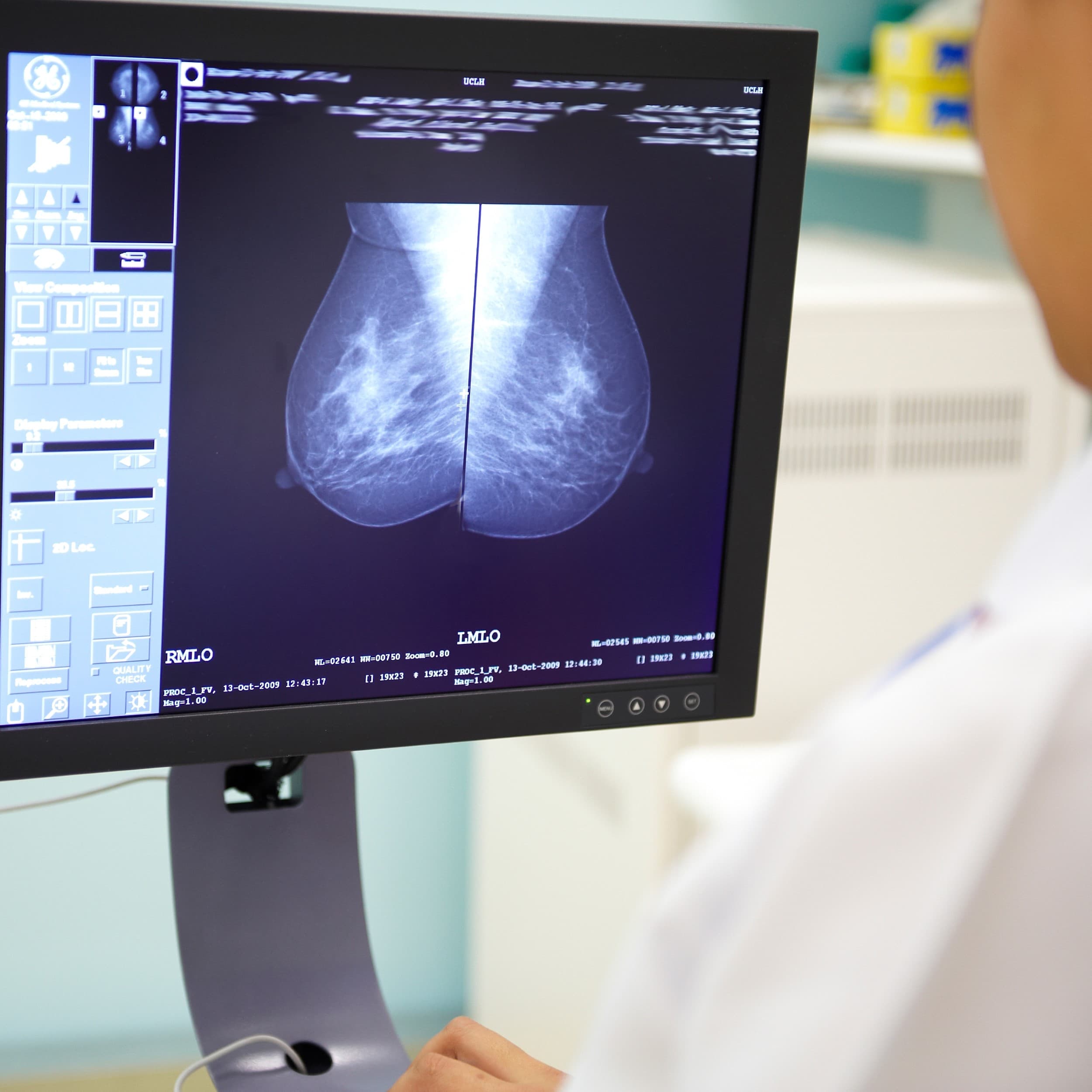 A radiographer examining a mammogram image.
